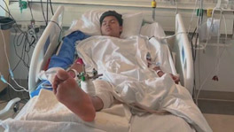 Gelvy Ortiz Loses Leg After Being Hit by Alleged Drunk Driver in Santa Monica