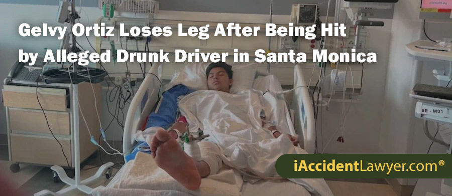 Gelvy Ortiz Loses Leg After Being Hit by Alleged Drunk Driver in Santa Monica